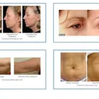 Unternehmen 3 Bild STUDIO DI MEDICINA ESTETICA DR. MED. MONIQUE WORTELBOER Ärzte am Lugano TI